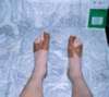 Hansaplast half �ber das schlimmste hinweg